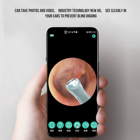 Smart WIFI Visual Ear Cleaner and Ear Wax Removal with HD Camera