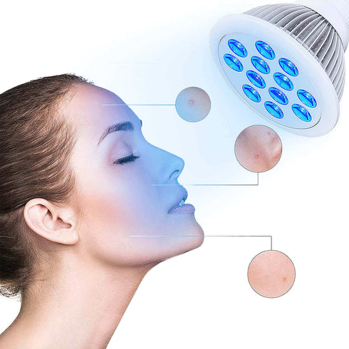 lukirch 24w blue led light therapy lamp 450nm for removing acne of women and men