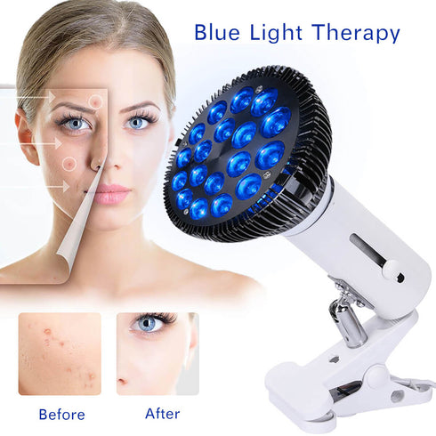 lukirch blue led light therapy lamp 54w 540nm is good for acne of woman and man